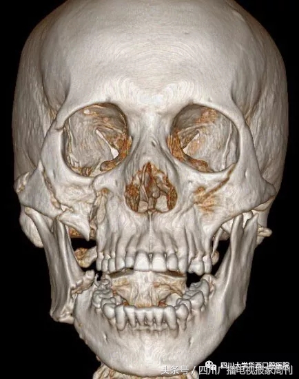 嘴巴张不开是为啥,牙疼嘴巴张不开是什么原因