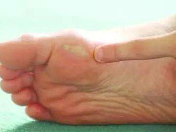 怎么预防跑步脚磨出水泡,脚底跑步磨出水泡怎么办