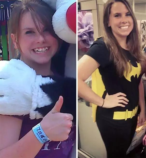 后悔整牙和不后悔整牙,整牙一般整到什么样就可以了