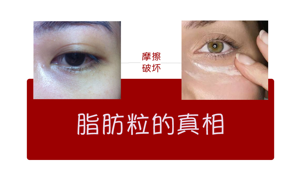 女大学生泪沟黑眼圈用什么眼霜,眼霜能去脂肪粒吗