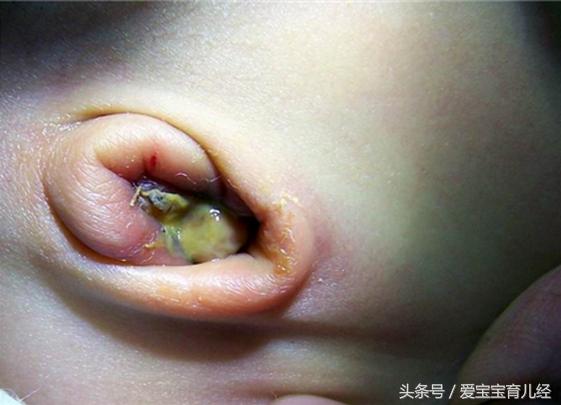 宝宝腹胀怎么按摩治疗,3岁宝宝腹胀的快速解决方法