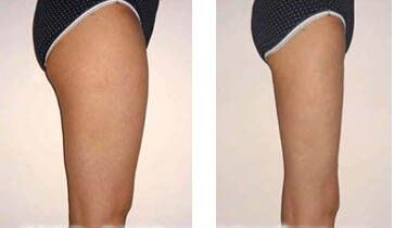 女人出现哪些征兆是闭经的现象,女性绝经后反复发作尿灼热的症状