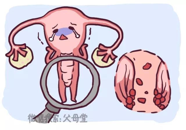 女性的可怕疾病,这类女性疾病要重视