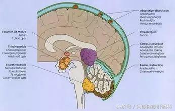 人血白蛋白可以治疗腿脚水肿吗,白蛋白对脑出血水肿有好处吗