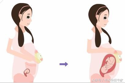 哮喘孕妇的最佳治疗方法,哮喘患者饮食注意事项有哪些