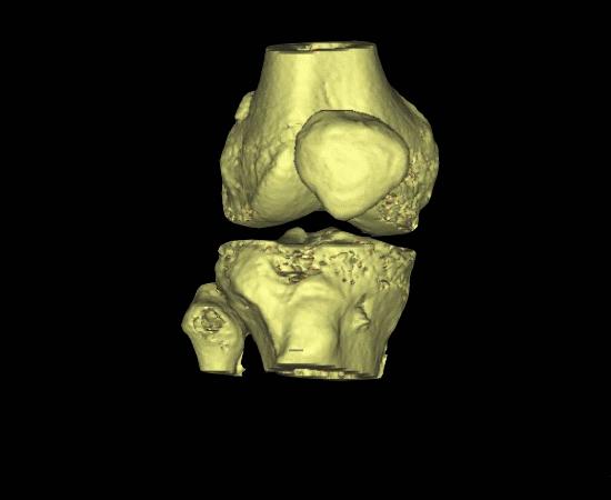 慢跑膝盖疼的恢复方法,慢跑为什么膝盖会疼