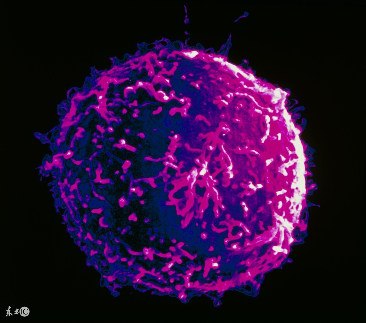 别大意这些症状可能是癌症信号,这些癌症早期症状你最好早点知道