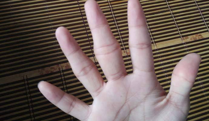 经常掰手指关节导致关节粗怎么办,老是想掰响指关节怎么办