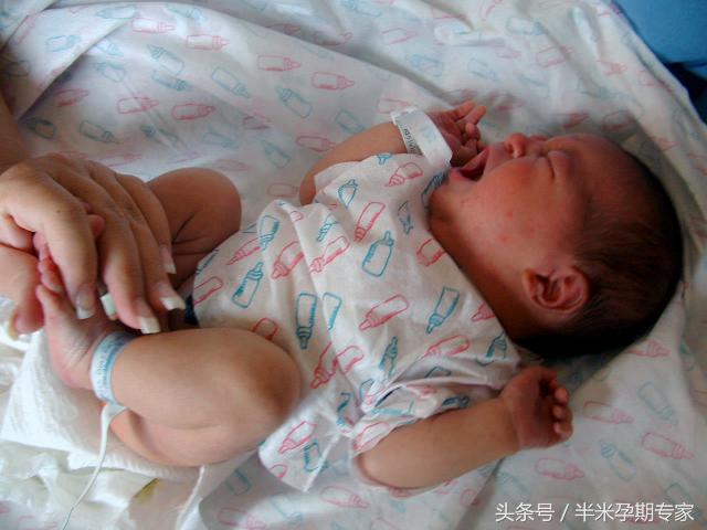 新生儿湿疹和热疹擦什么药,新生儿湿疹和尿布疹怎么办