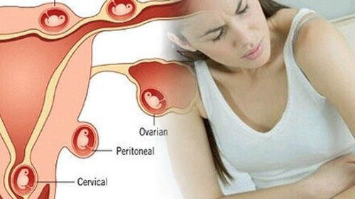 濂冲瓙璇俊鍋忔柟,濂冲瓙姹傚瓙璇俊鍋忔柟