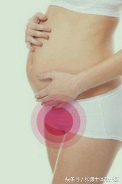 孕期耻骨痛怎么训练恢复,孕期耻骨疼怎么锻炼