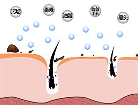 黑头大作战！小窍门彻底跟黑头说ByeBye！（上）