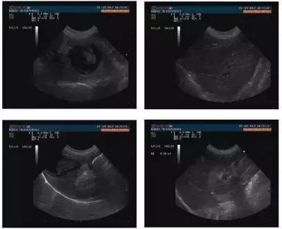 宠物狗胰腺炎的症状与治疗方法,狗狗胰腺炎其实和犬种有关