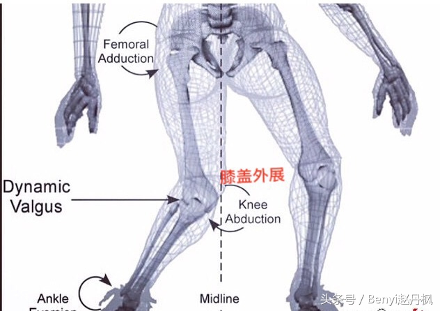 膝关节疼痛如何预防和干预,膝盖常见伤病症状