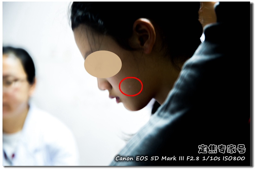 头皮有白色癣块去医院大概多少钱,治头皮问题的药一般多少钱