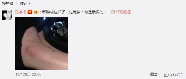 奚梦瑶摔倒后腿如何了,奚梦瑶受伤片段