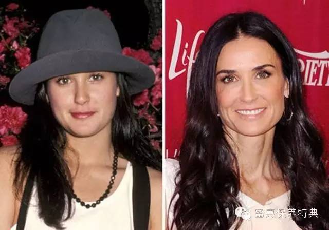 欧美阿姨PK日本大妈——差了10斤胶原蛋白！