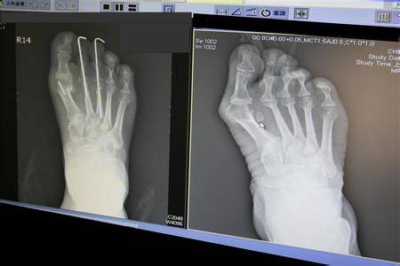 心疼！*疆新**妹子身上的这个痛，光看着就想上去抱抱！