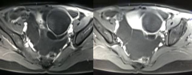 中下腹胀痛见于哪些疾病,女性下腹坠痛是不是有炎症
