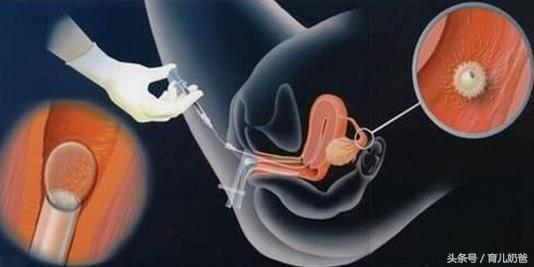 试管婴儿从开始到成功需要多久,试管婴儿到哪一步才是真正成功