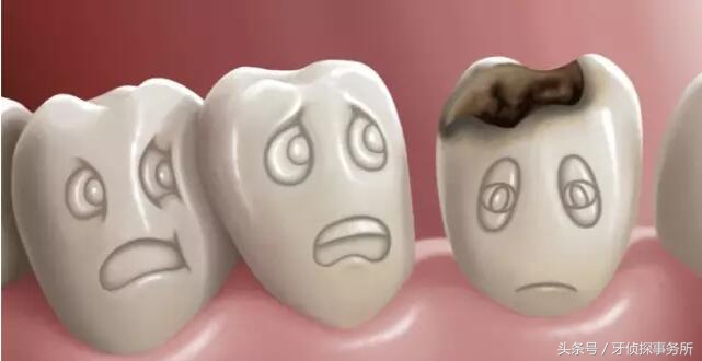 用了舒客牙膏牙齿对冷热敏感,牙齿敏感松动用什么牙膏最好