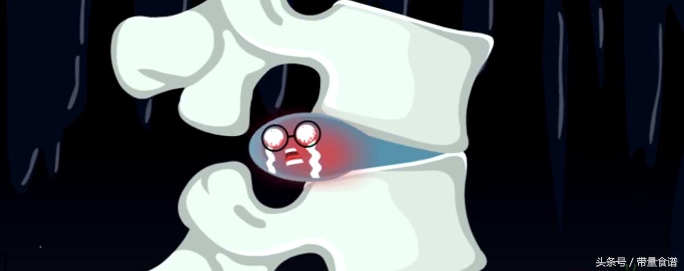 坐不久就腰痛怎么回事,坐着的时候腰椎间盘突出