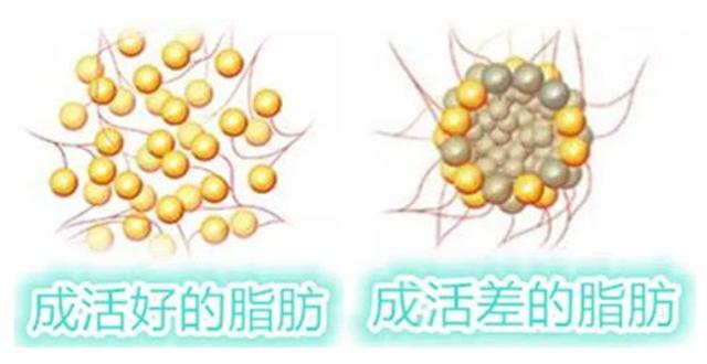 科普：自体脂肪面部填充有哪些优缺点、有哪些风险呢？