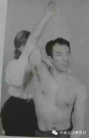 肩峰撞击综合征肩袖损伤怎么治疗,肩峰下撞击综合征导致肩袖损伤