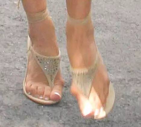 心疼！*疆新**妹子身上的这个痛，光看着就想上去抱抱！