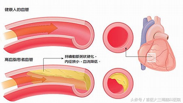 脑供血不足能导致失眠耳鸣吗,耳鸣头晕脑供血不足怎么办
