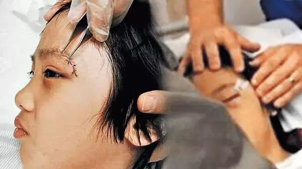 满月的宝宝眼病筛查要做吗,婴儿眼病检查哪些