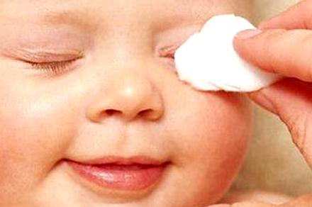 宝宝眼屎多是上火吗该怎么护理呢,解决眼屎多的秘方