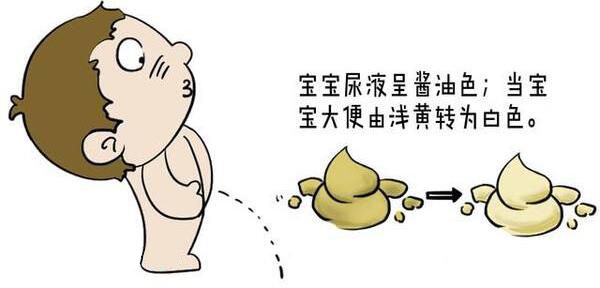 宝宝黄疸的护理方法,宝宝黄疸的几个护理技巧