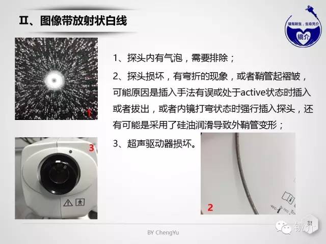 内镜超声小探头设定、使用、维护要点分析