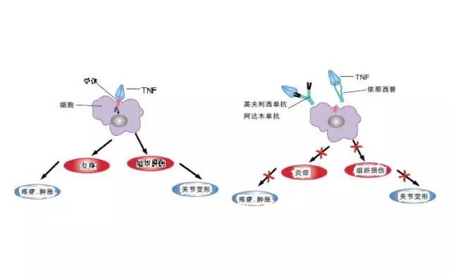 银屑病生物制剂可善挺,银屑病用生物制剂效果如何