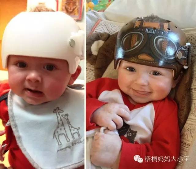 小孩子学走路买学步带吗,学步带带子