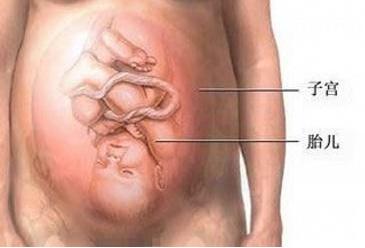 经历了剖腹产才知道妈妈的不容易,看了剖腹产才明白妈妈是多么伟大