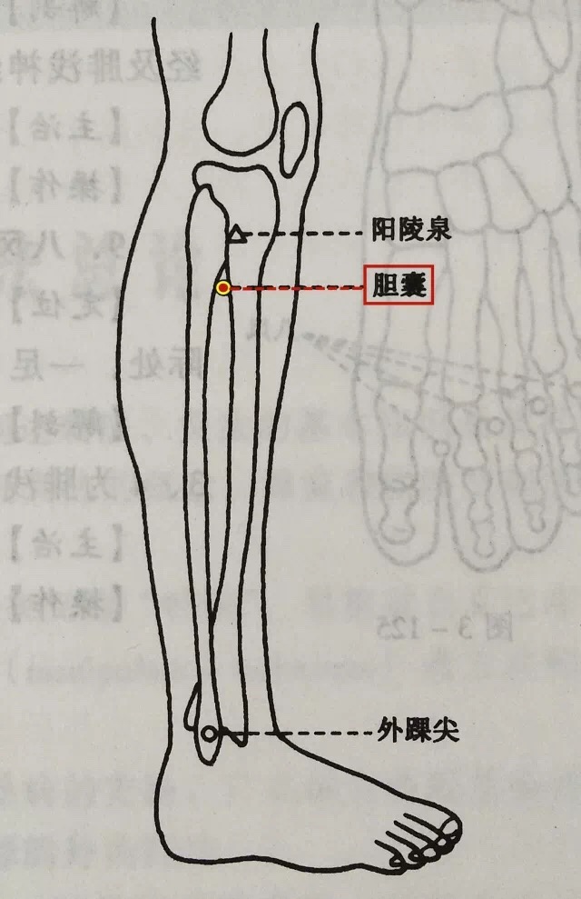 期门穴拔罐治胆囊炎吗,胆囊炎拔罐针灸管用吗