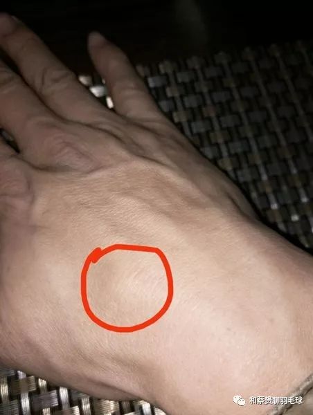 小腿前面的肌肉僵硬,小腿前方肌肉僵硬