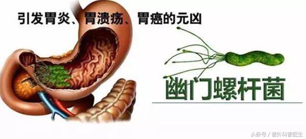 打嗝肚子胀气消化不良怎么办,一直打嗝不停是消化不良吗