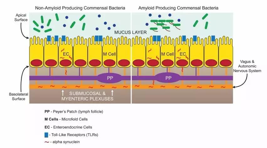 肠道细菌感染会引发肠痉挛吗,肠道细菌可以改变大脑吗