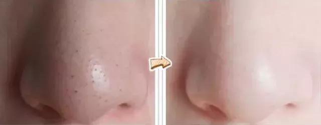 敏感肌卸妆洁面乳,适合敏感肌用的去角质洁面乳