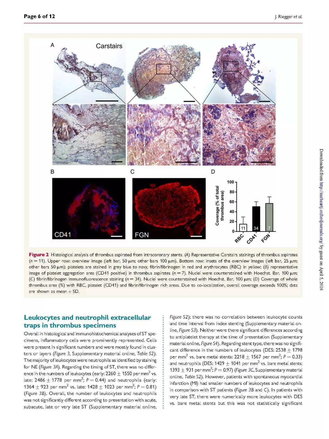 支架内血栓怎么处理,支架内血栓的原因及表现