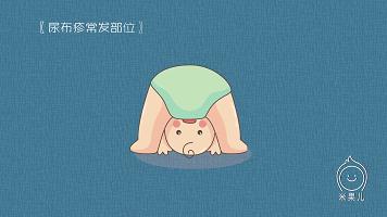 宝宝过敏怎么办新手爸妈秘籍,妈妈过敏体质宝宝怎么办