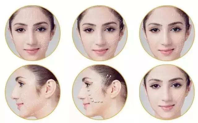 做完线雕真的会年轻吗,经常做线雕面部会年轻吗