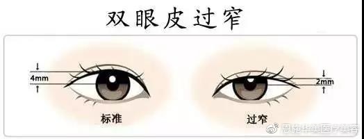 眼部整形常见的15个问题,眼部护理要避开九大误区