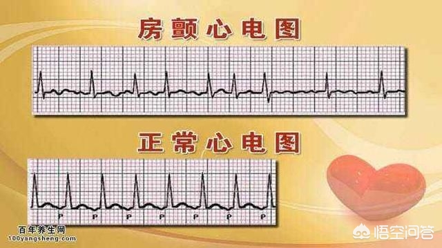 房颤射频消融术后怎么运动好,房颤的射频消融术效果怎么样