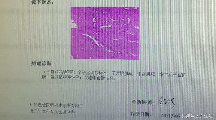 子宫腺肌症中医病历,子宫腺肌病疑难病例分析报告