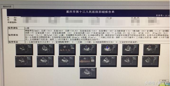 头晕夜尿多身上痒是什么原因,皮肤瘙痒是肾病的表现吗