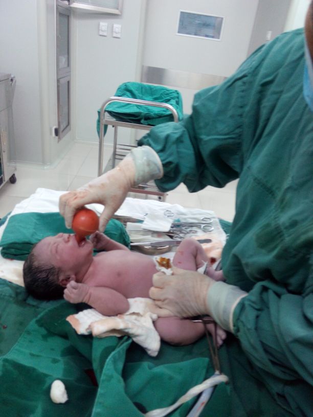 38周左枕横位羊水偏少能顺产,羊水偏少生下来的宝宝正常吗